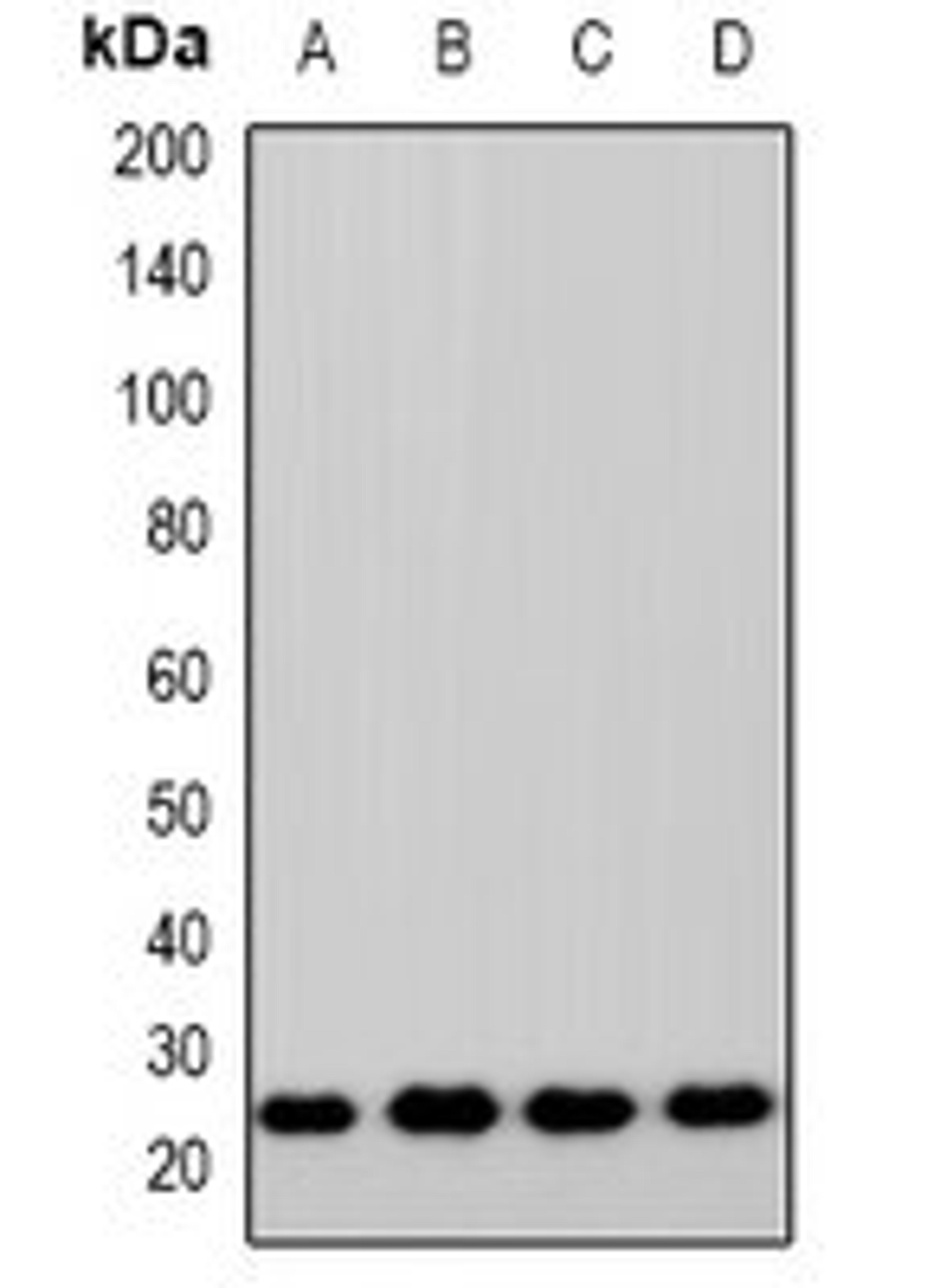 Western blot analysis of HEK293T (Lane1), A549 (Lane2), RAW264.7 (Lane3), H9C2 (Lane4) whole cell lysates using ZNRF2 antibody