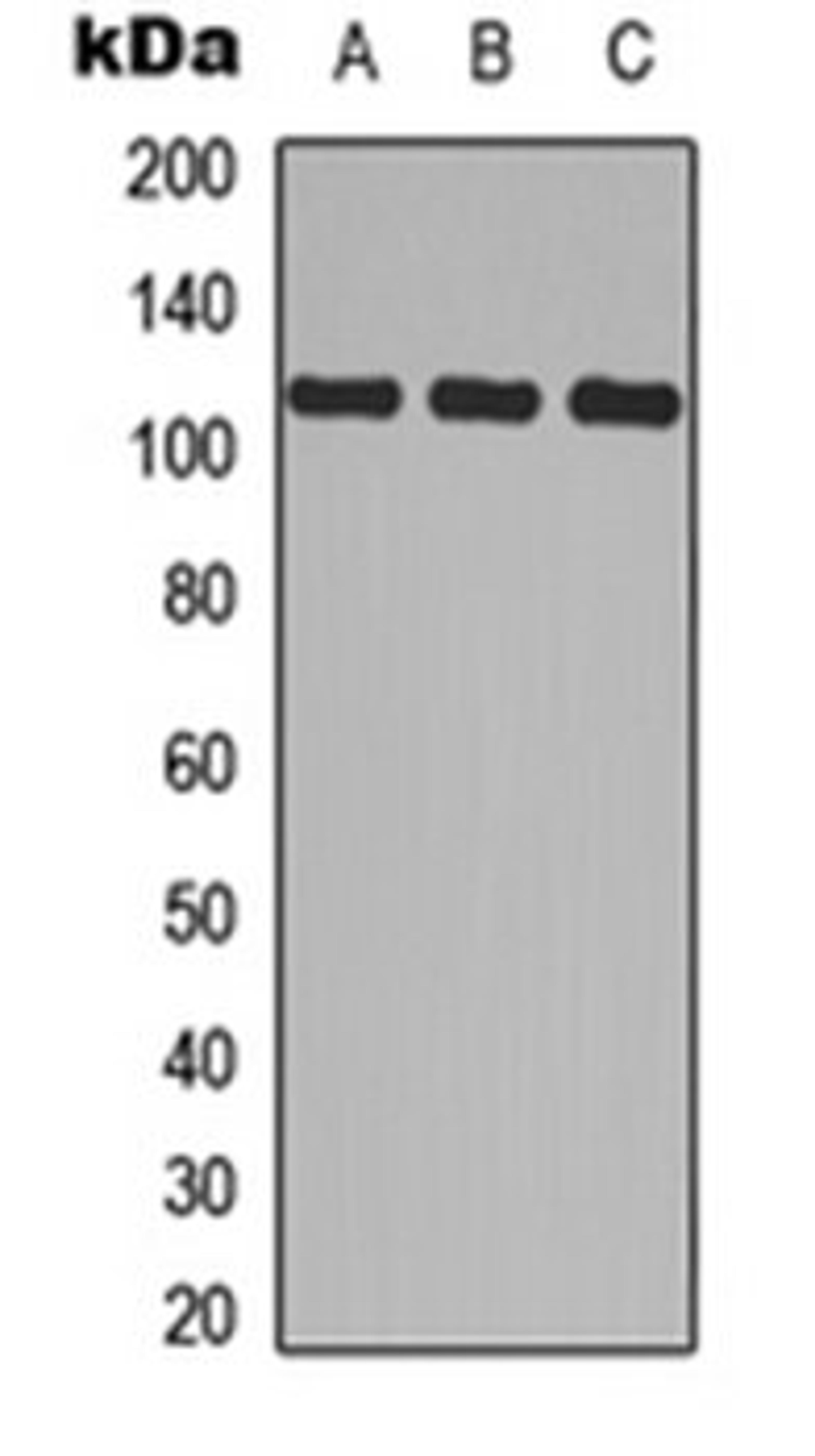 Western blot analysis of MCF7 (Lane 1), Raw264.7 (Lane 2), PC12 (Lane 3) whole cell lysates using CD41 HC antibody