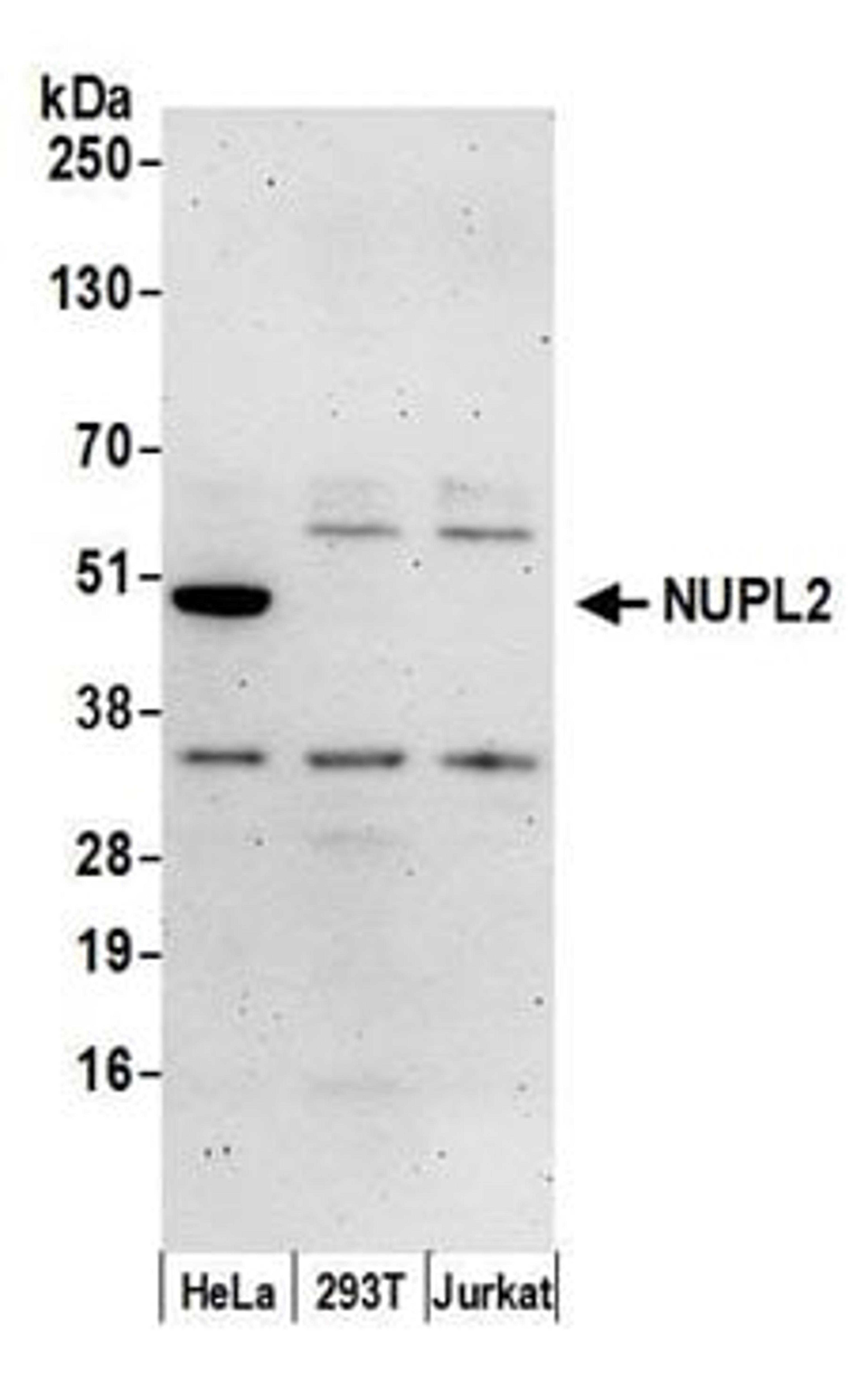 Detection of human NUPL2 by western blot.