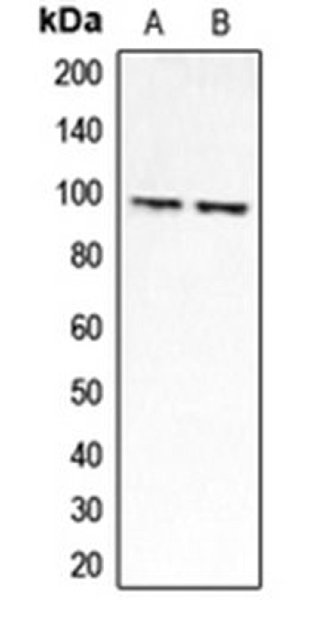 Western blot analysis of HEK293A (Lane 1), Jurkat (Lane 2) whole cell lysates using CLCN6 antibody