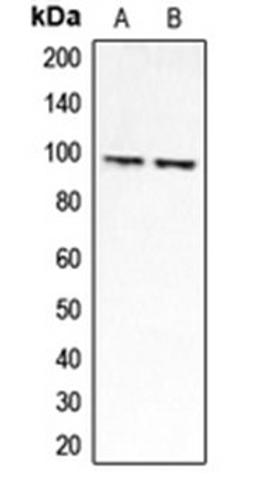 Western blot analysis of HEK293A (Lane 1), Jurkat (Lane 2) whole cell lysates using CLCN6 antibody