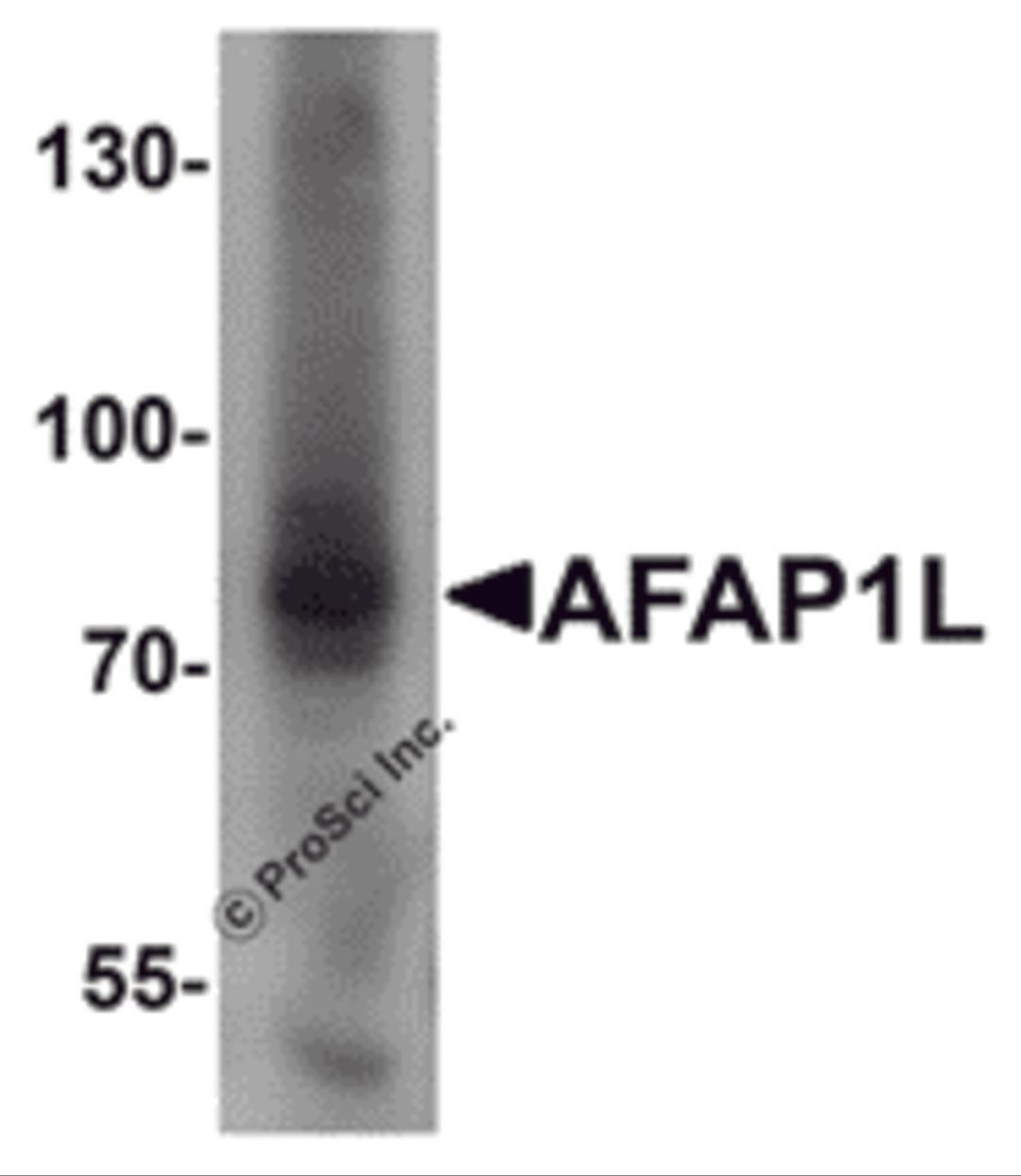 Western blot analysis of AFAP1L1 in A549 cell lysate with AFAP1L1 antibody at 1 &#956;g/mL.