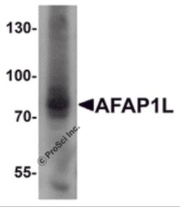 Western blot analysis of AFAP1L1 in A549 cell lysate with AFAP1L1 antibody at 1 &#956;g/mL.