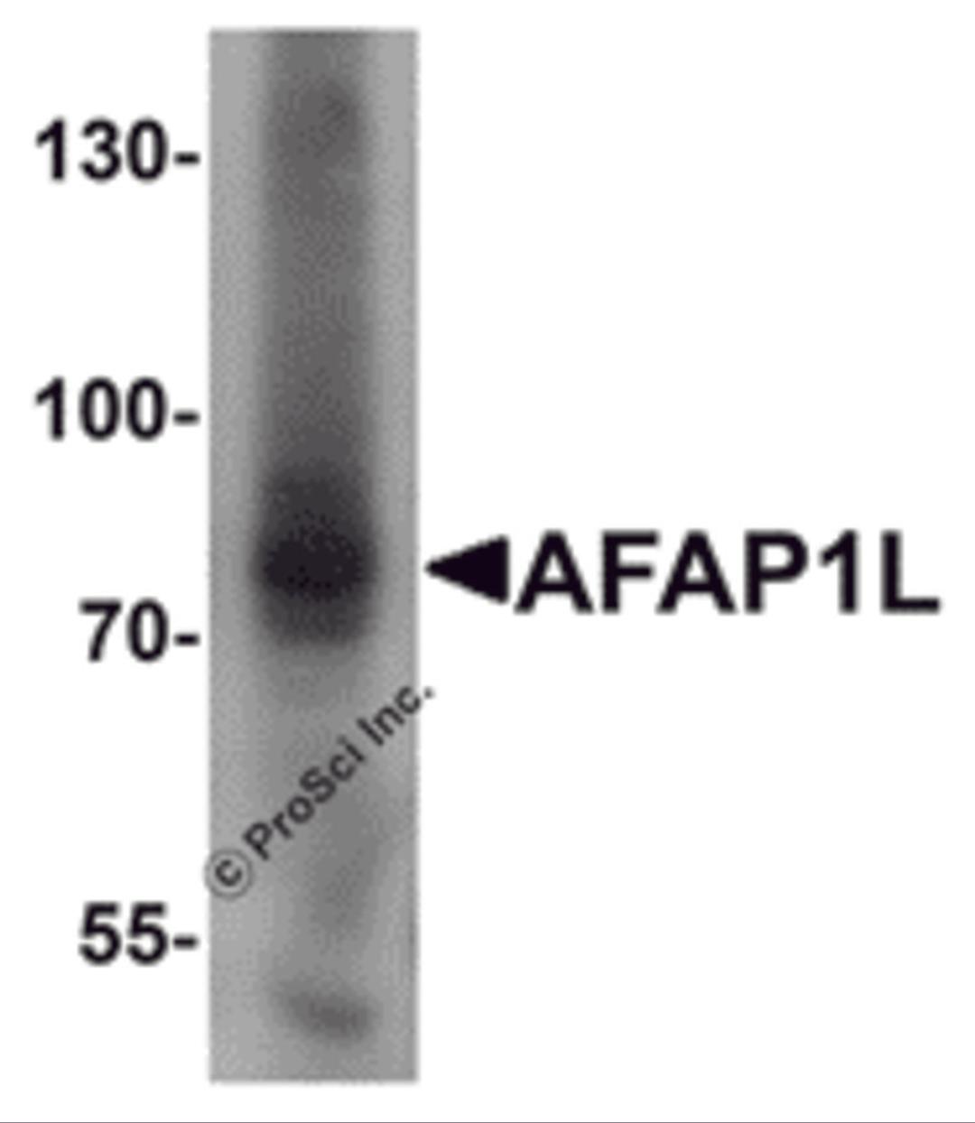 Western blot analysis of AFAP1L1 in A549 cell lysate with AFAP1L1 antibody at 1 μg/mL.