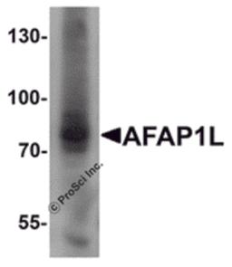 Western blot analysis of AFAP1L1 in A549 cell lysate with AFAP1L1 antibody at 1 μg/mL.