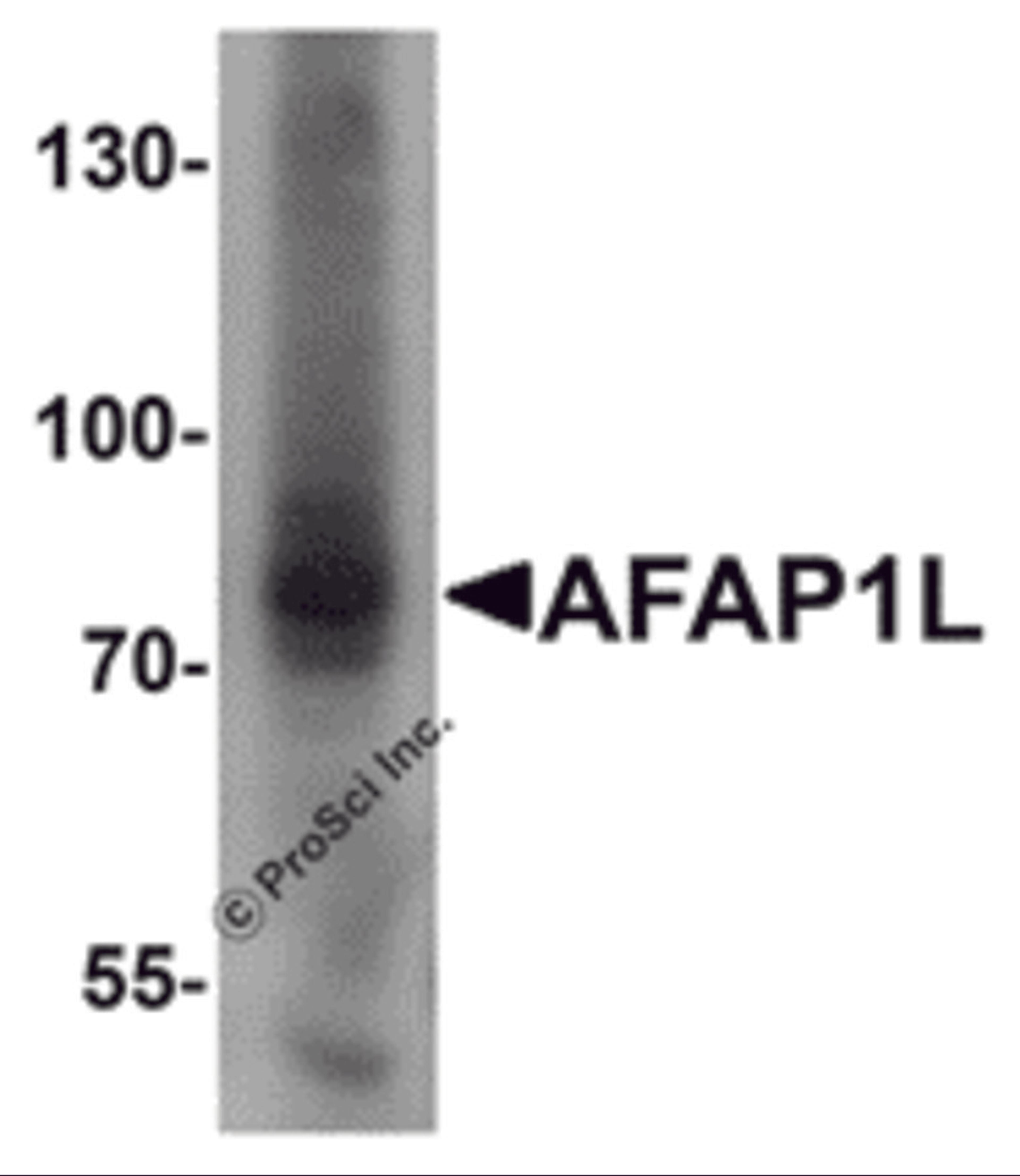 Western blot analysis of AFAP1L1 in A549 cell lysate with AFAP1L1 antibody at 1 μg/mL.
