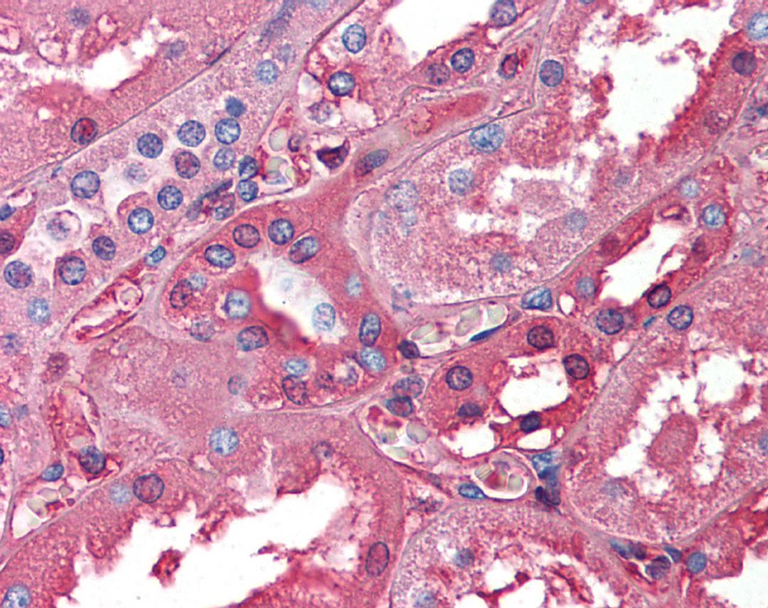 Antibody used in IHC on Human Kidney.