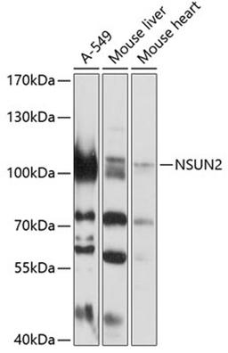 Western blot - NSUN2 antibody (A3443)