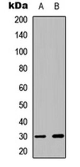 Western blot analysis of HT29 PMA-treated (Lane 1), HEK293 PMA-treated (Lane 2) whole cell lysates using CDK5 (phospho-Y15) antibody