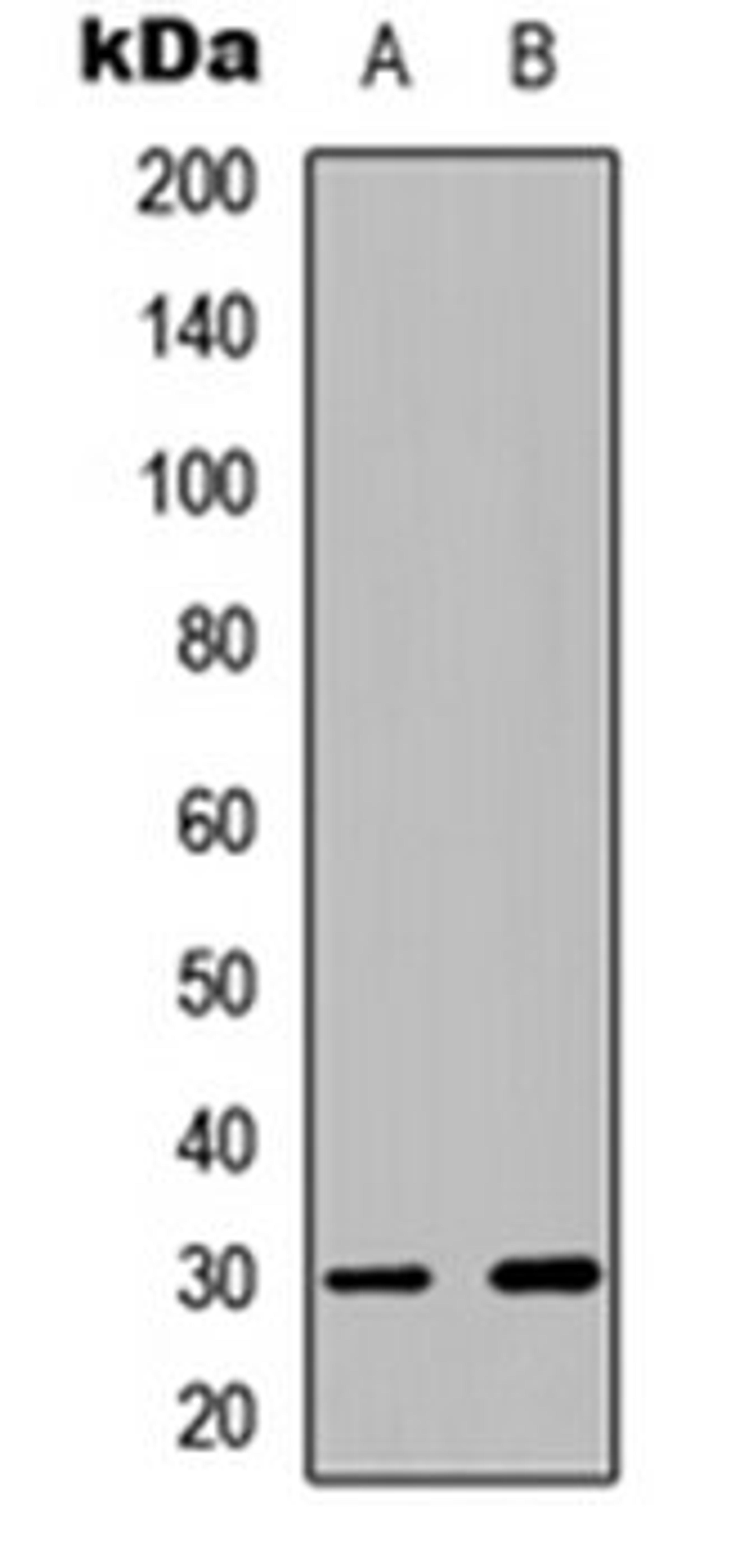 Western blot analysis of HT29 PMA-treated (Lane 1), HEK293 PMA-treated (Lane 2) whole cell lysates using CDK5 (phospho-Y15) antibody