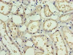 Immunohistochemistry of paraffin-embedded human kidney tissue using CSB-PA878890HA01HU at dilution of 1:100