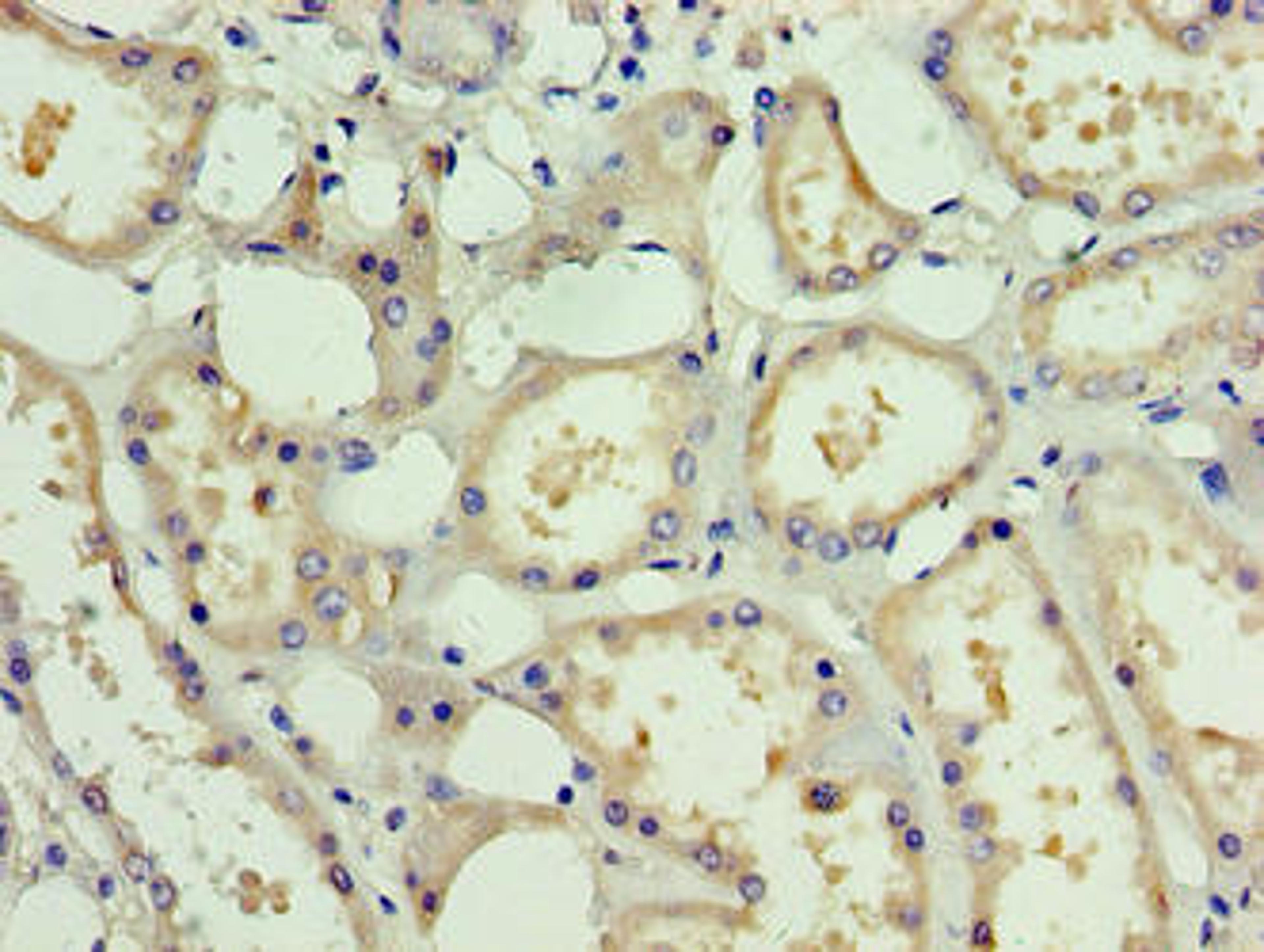 Immunohistochemistry of paraffin-embedded human kidney tissue using CSB-PA878890HA01HU at dilution of 1:100
