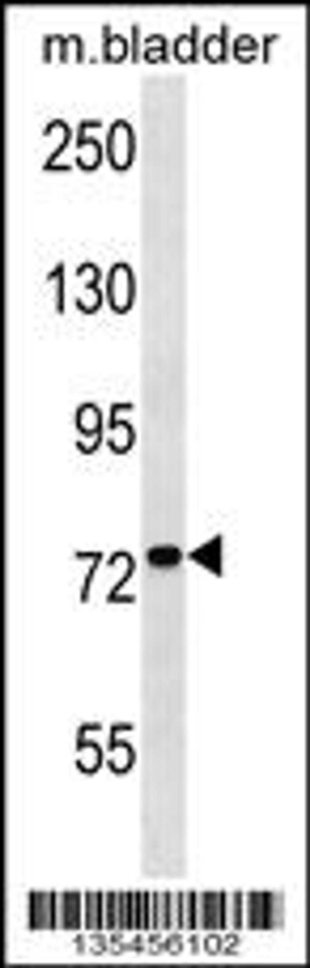 Western blot analysis in mouse bladder tissue lysates (35ug/lane).