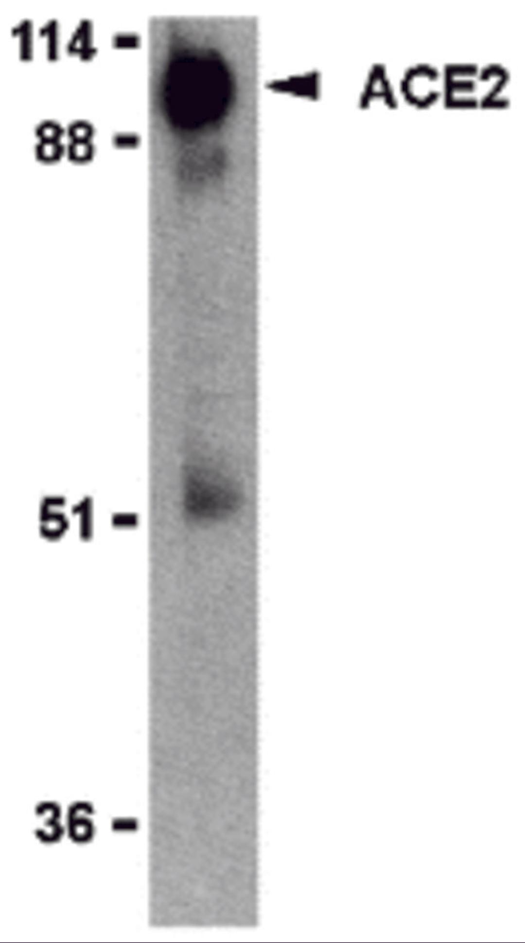 Western blot analysis of ACE2 in human kidney lysate with ACE2 antibody (IN2) at 2 μg/mL.