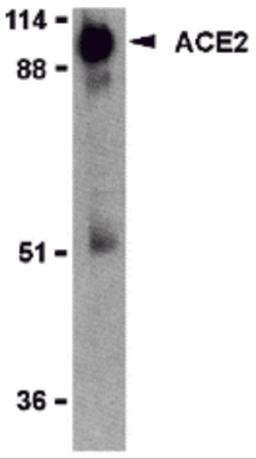 Western blot analysis of ACE2 in human kidney lysate with ACE2 antibody (IN2) at 2 μg/mL.