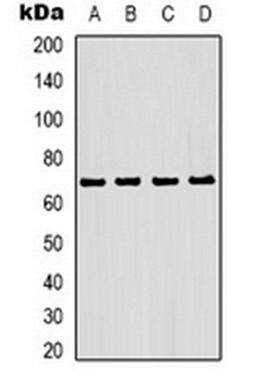 Western blot analysis of Hela (Lane 1), MCF7 (Lane 2), mouse liver (Lane 3), rat liver (Lane 4) whole cell lysates using Estrogen Receptor alpha antibody