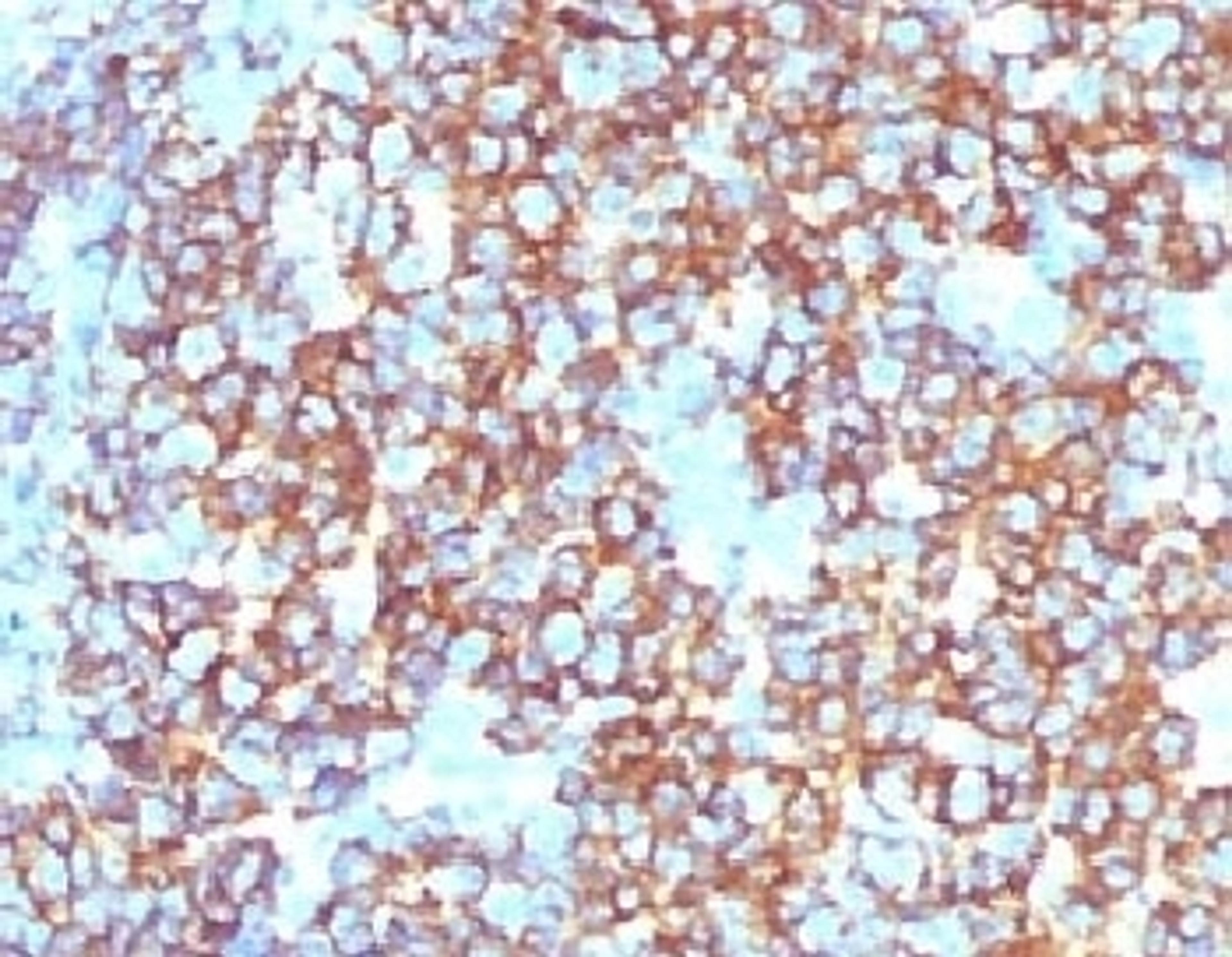 IHC testing of recombinant CD20 antibody and FFPE human tonsil tissue. HIER: steam section in pH6 citrate buffer for 20 min.