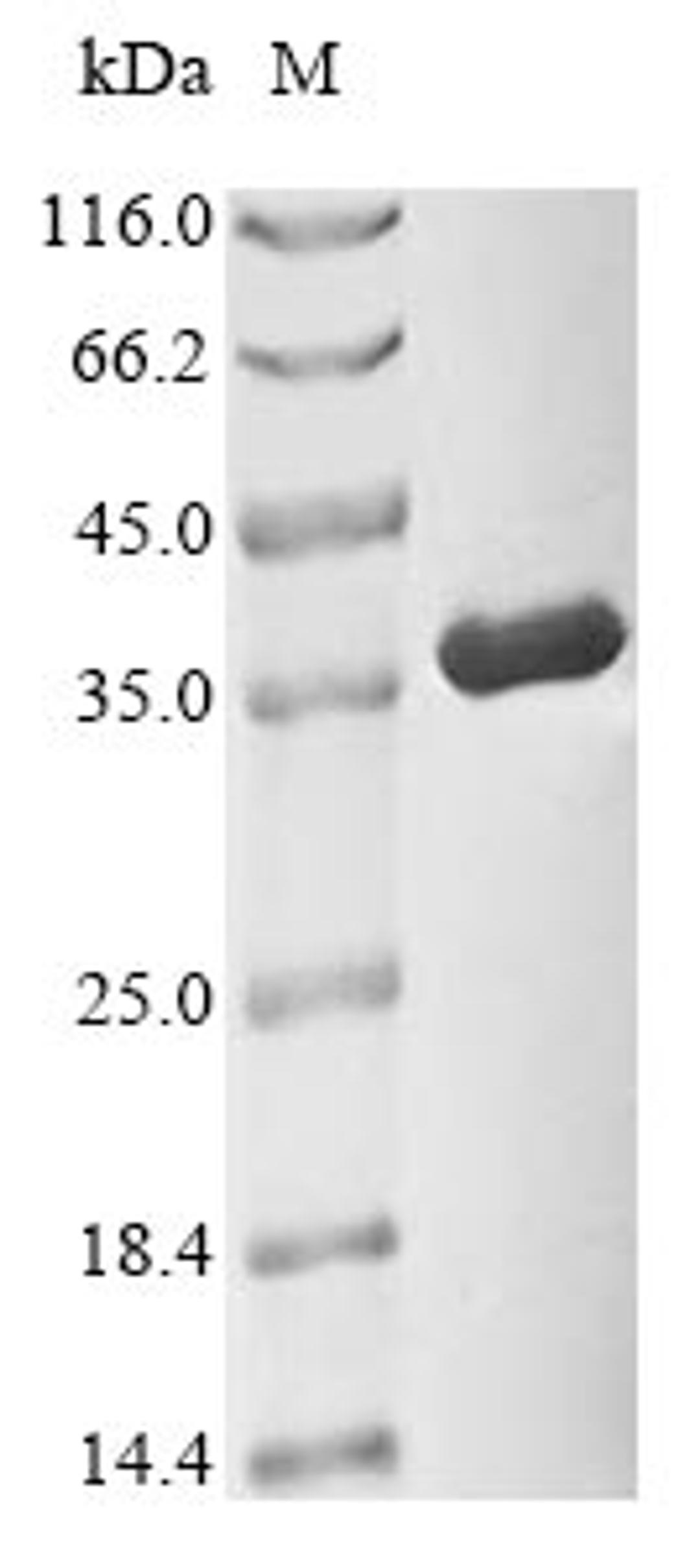 (Tris-Glycine gel) Discontinuous SDS-PAGE (reduced) with 5% enrichment gel and 15% separation gel.