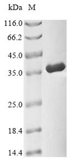 (Tris-Glycine gel) Discontinuous SDS-PAGE (reduced) with 5% enrichment gel and 15% separation gel.