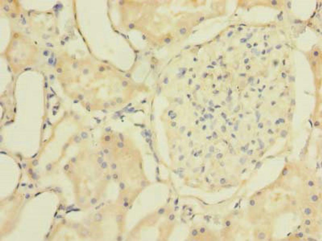 Immunohistochemistry of paraffin-embedded human kidney tissue using CSB-PA026975LA01HU at dilution of 1:100