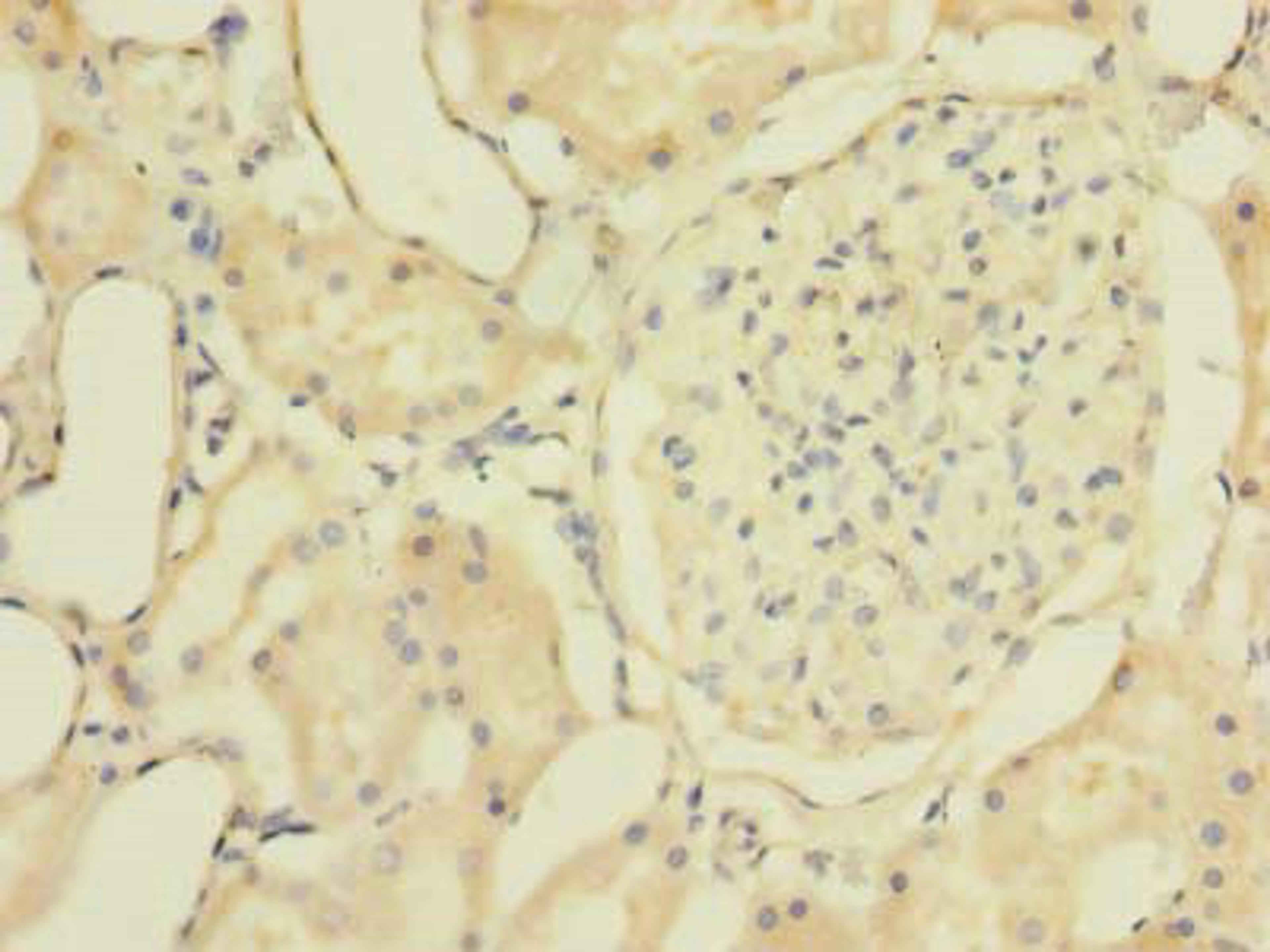Immunohistochemistry of paraffin-embedded human kidney tissue using CSB-PA026975LA01HU at dilution of 1:100