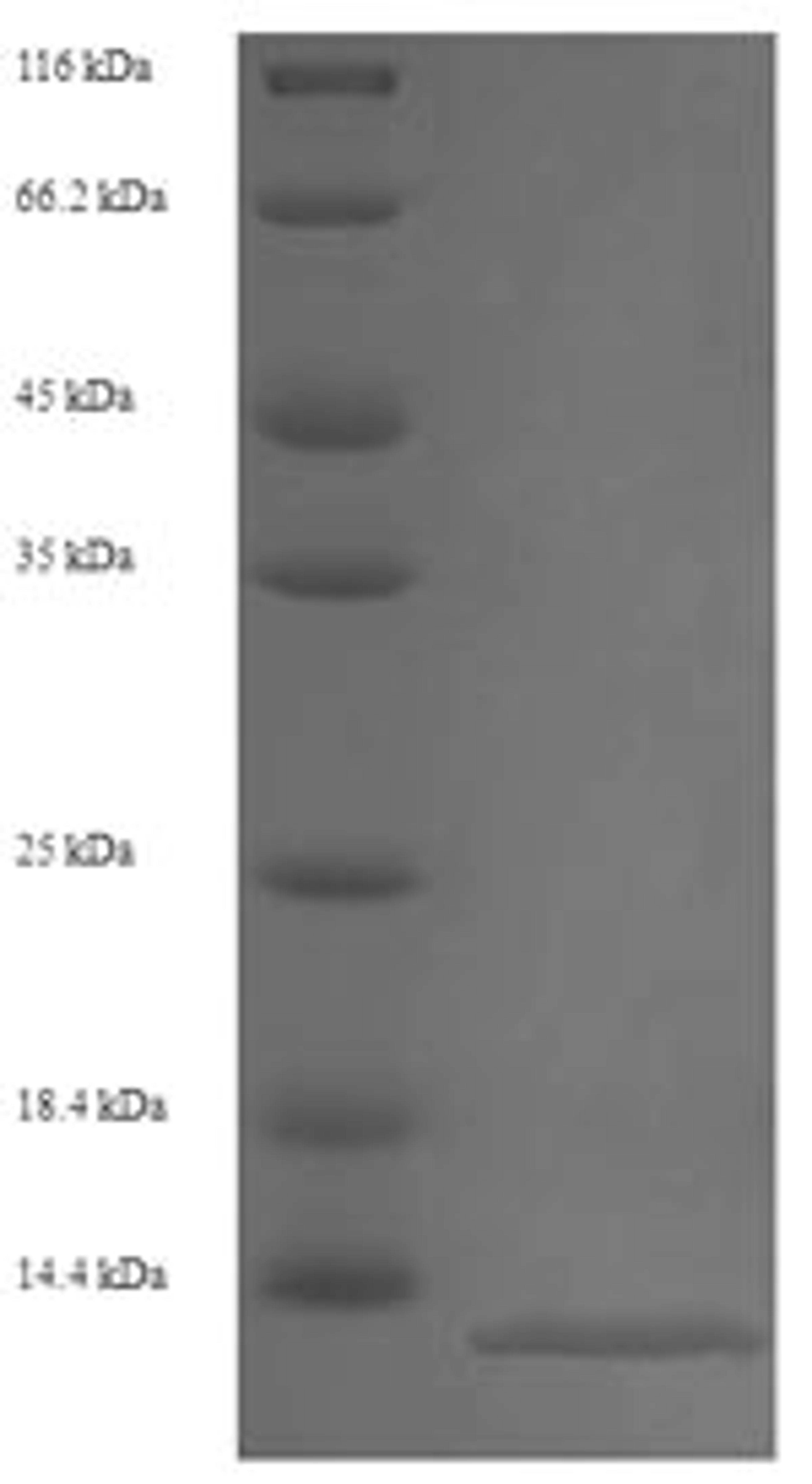 (Tris-Glycine gel) Discontinuous SDS-PAGE (reduced) with 5% enrichment gel and 15% separation gel.