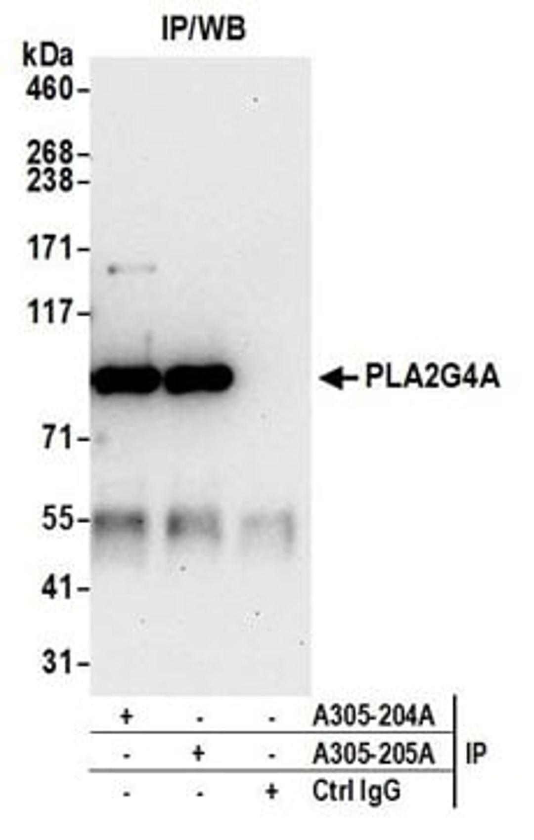 Detection of human PLA2G4A by western blot of immunoprecipitates.