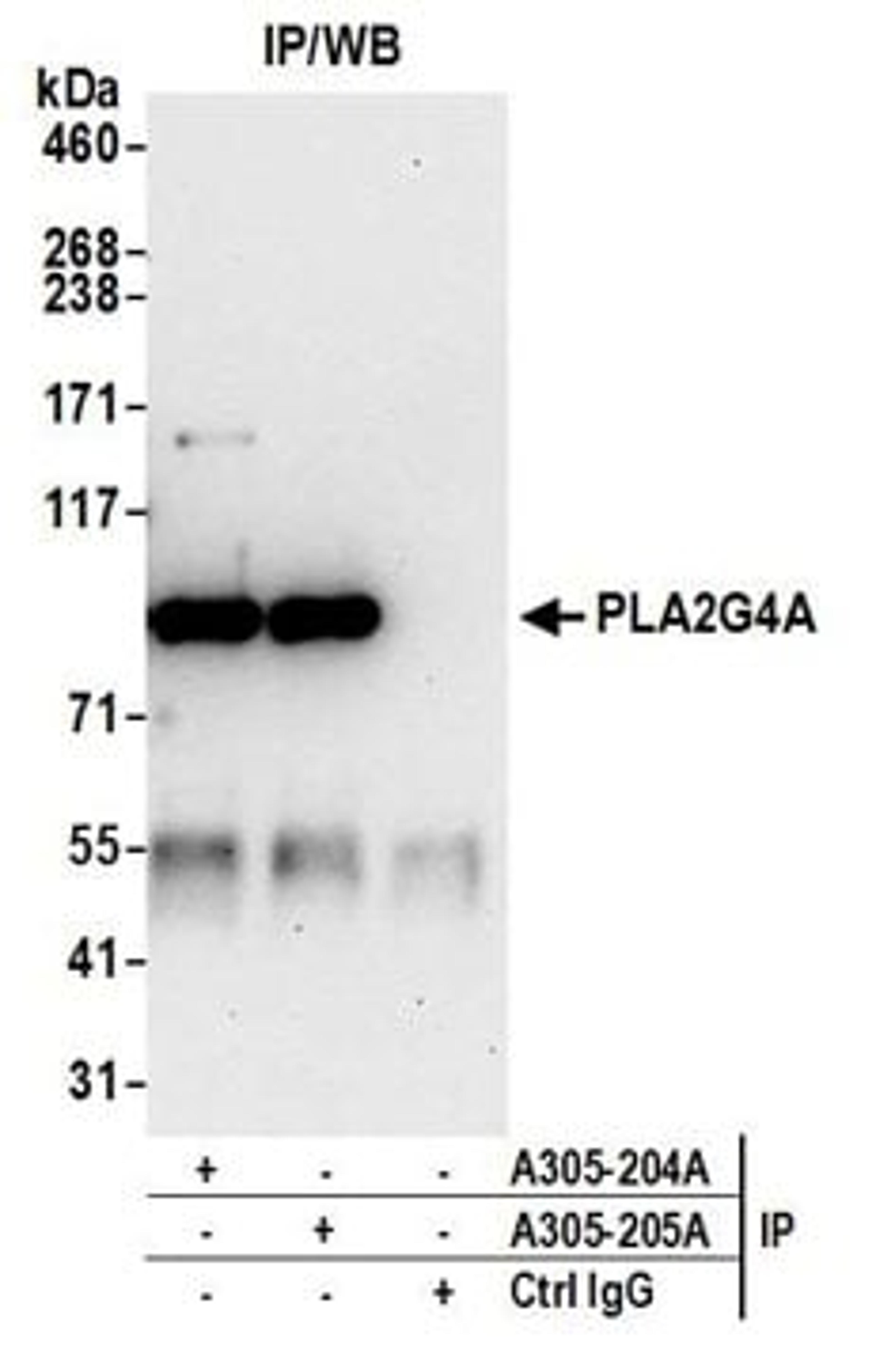 Detection of human PLA2G4A by western blot of immunoprecipitates.