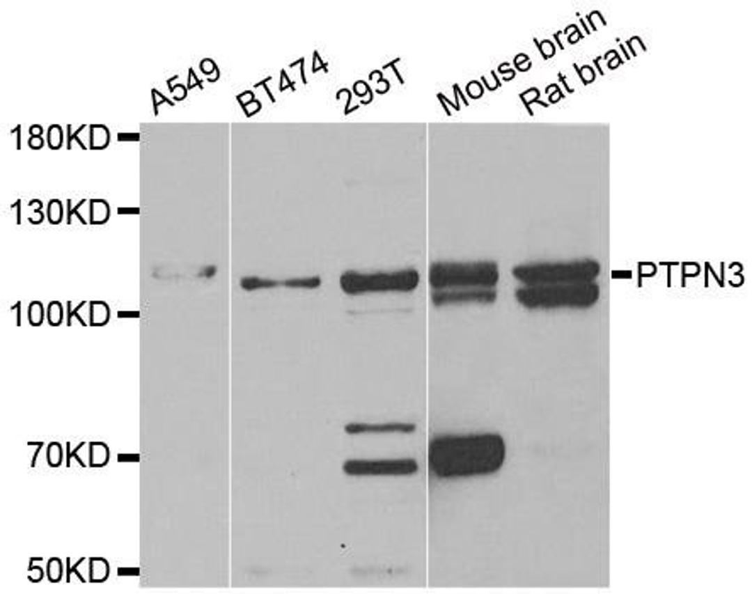 Western blot analysis of extracts of various cell lines using PTPN3 antibody