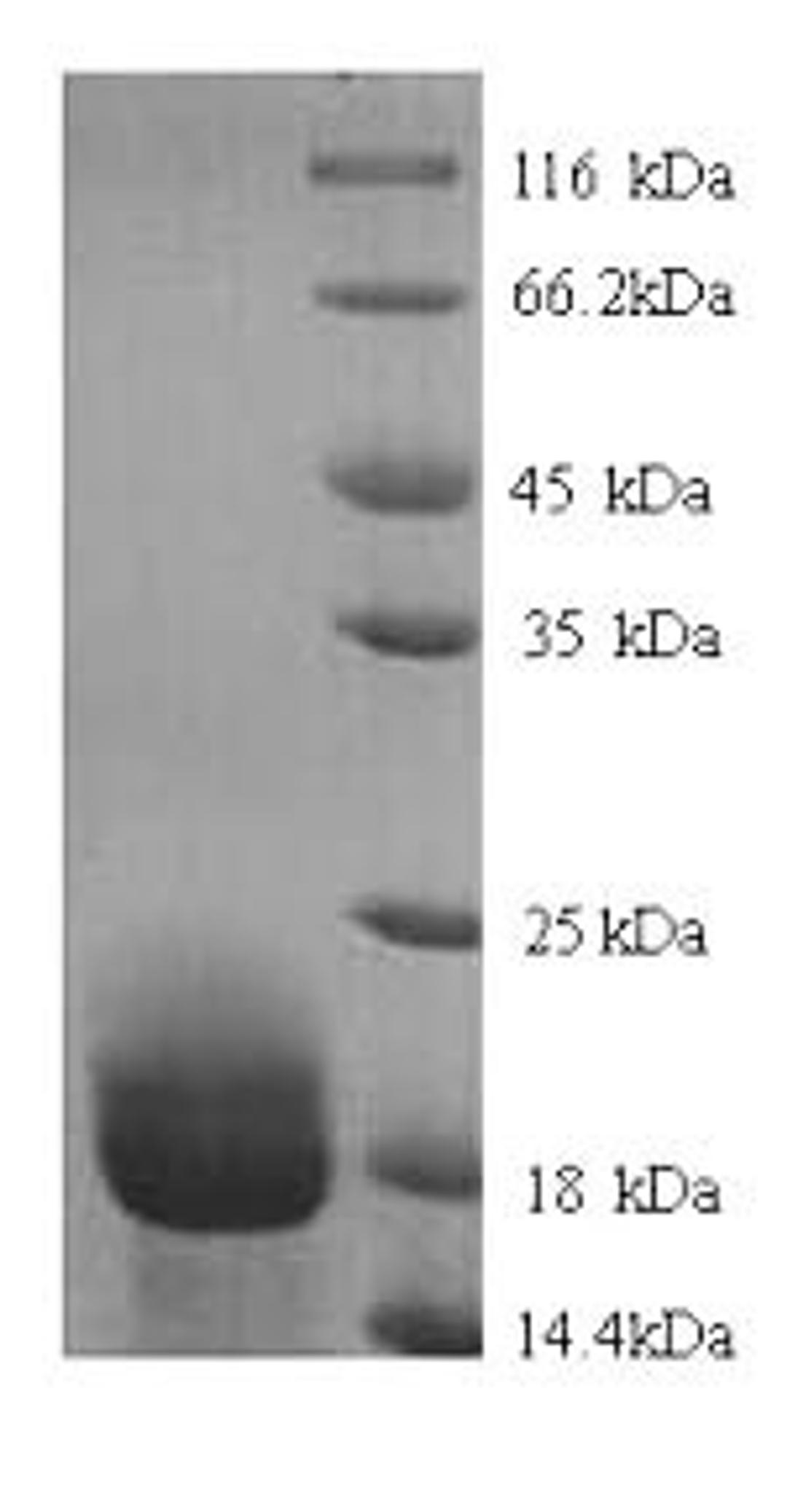 (Tris-Glycine gel) Discontinuous SDS-PAGE (reduced) with 5% enrichment gel and 15% separation gel.