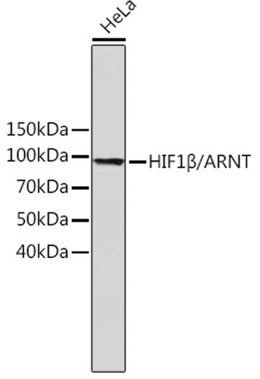 Western blot - HIF1ß/ARNT antibody (A19532)