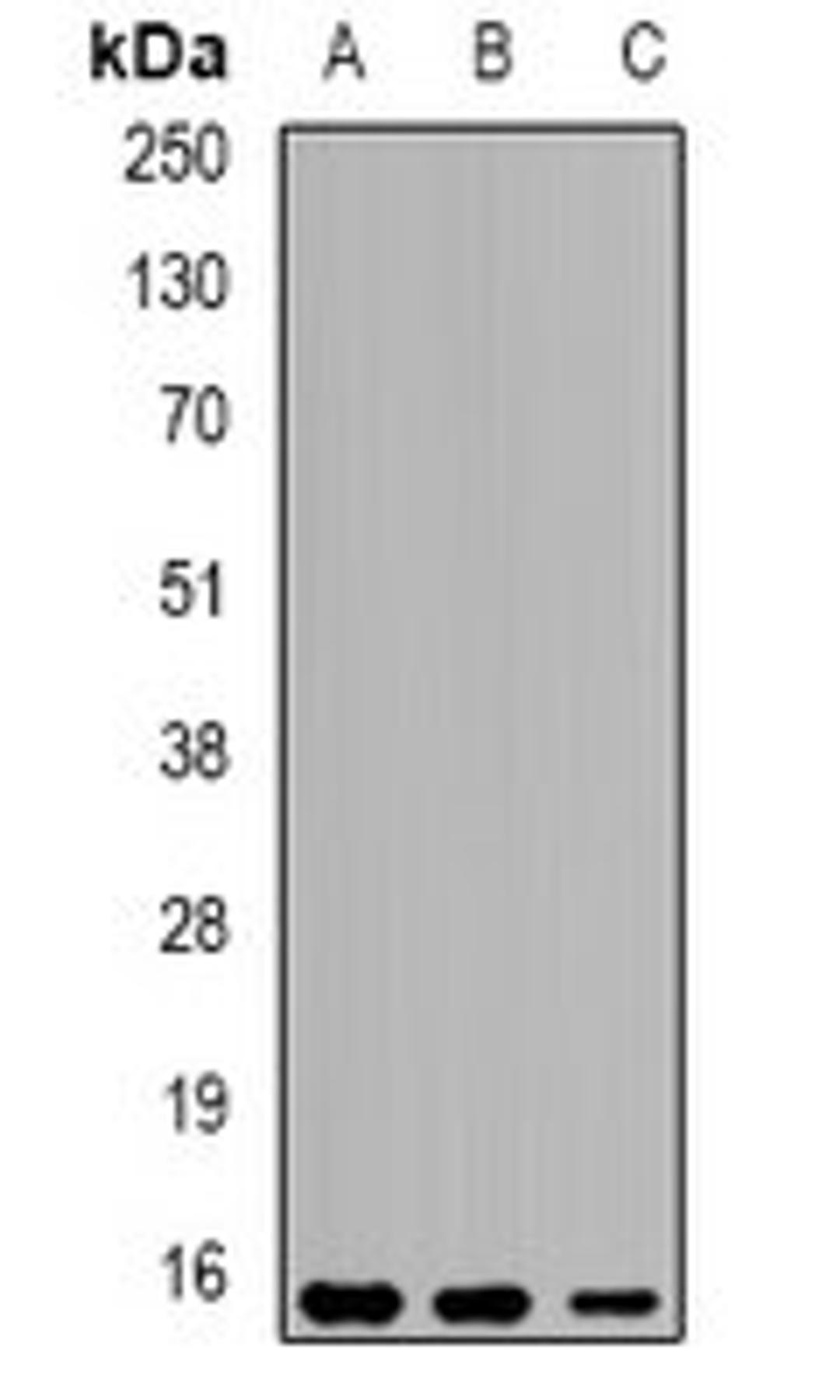 Western blot analysis of THP1 (Lane1), mouse liver (Lane2), mouse testis (Lane3) whole cell lysates using EPPIN antibody