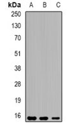 Western blot analysis of THP1 (Lane1), mouse liver (Lane2), mouse testis (Lane3) whole cell lysates using EPPIN antibody