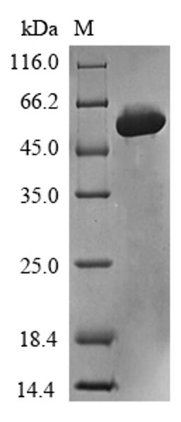 (Tris-Glycine gel) Discontinuous SDS-PAGE (reduced) with 5% enrichment gel and 15% separation gel.