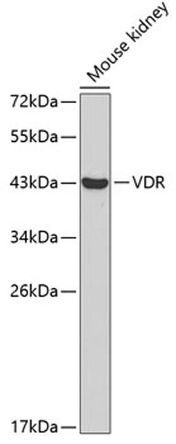 Western blot - VDR antibody (A2194)