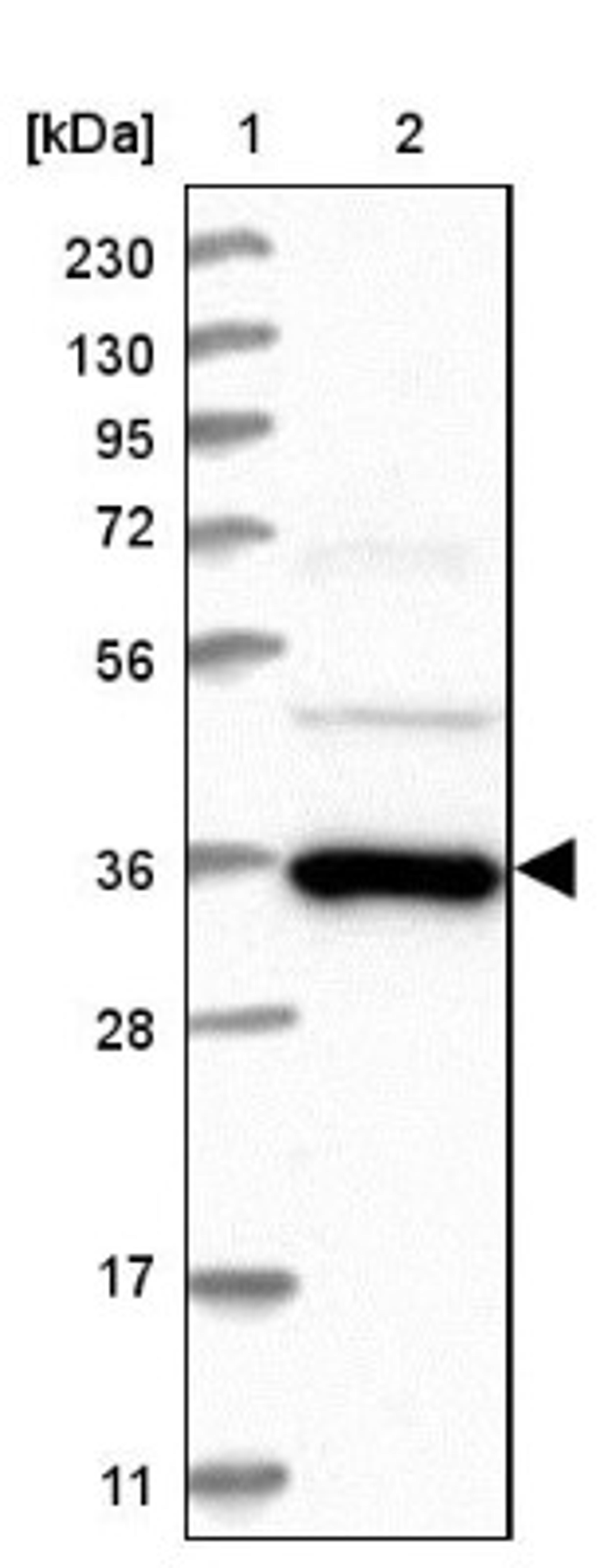 Western Blot: SYCP2L Antibody [NBP1-91163] - Lane 1: Marker [kDa] 230, 130, 95, 72, 56, 36, 28, 17, 11<br/>Lane 2: Human cell line RT-4