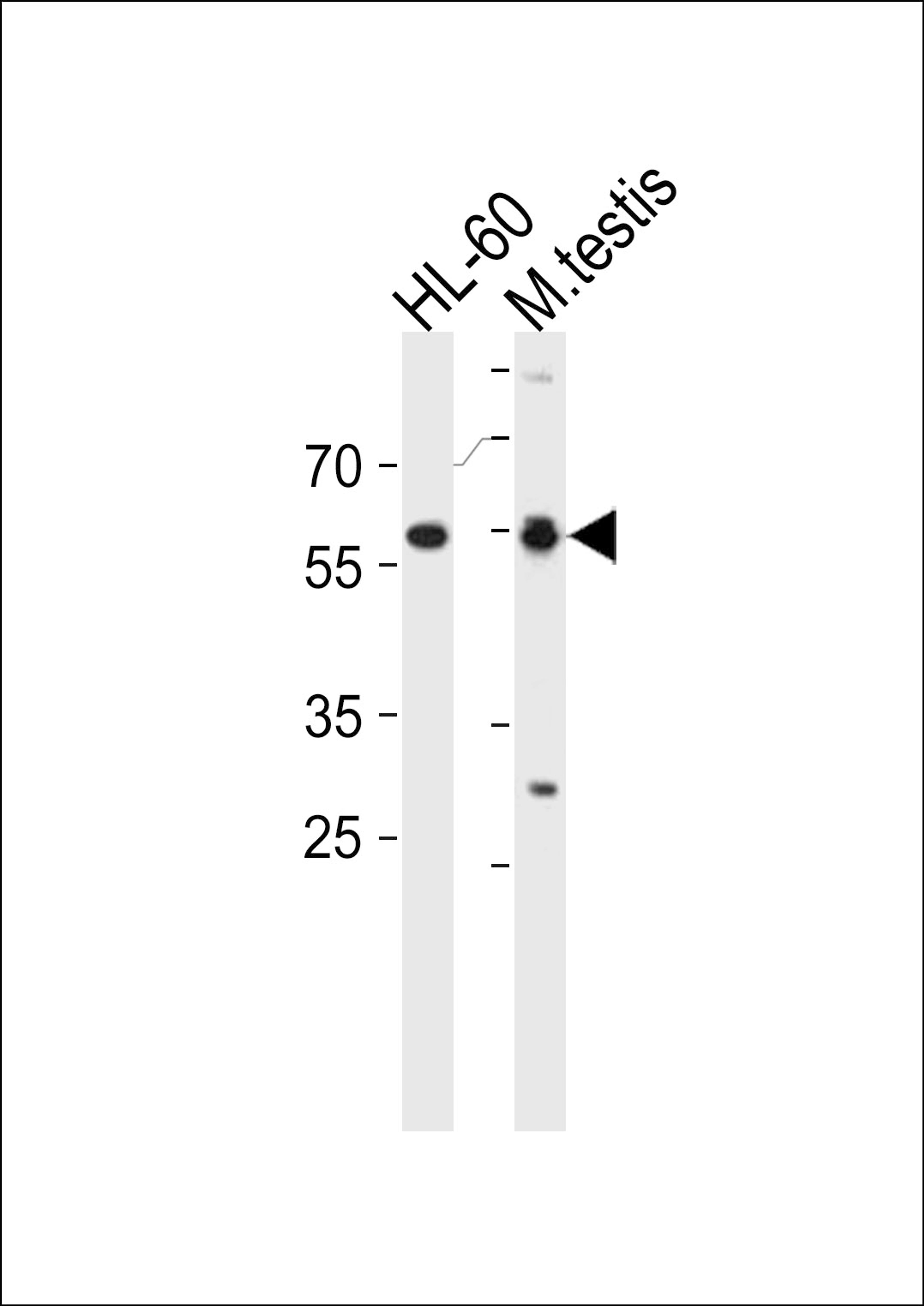 Western blot analysis in HL-60 cell line and mouse testis tissue lysates (35ug/lane).