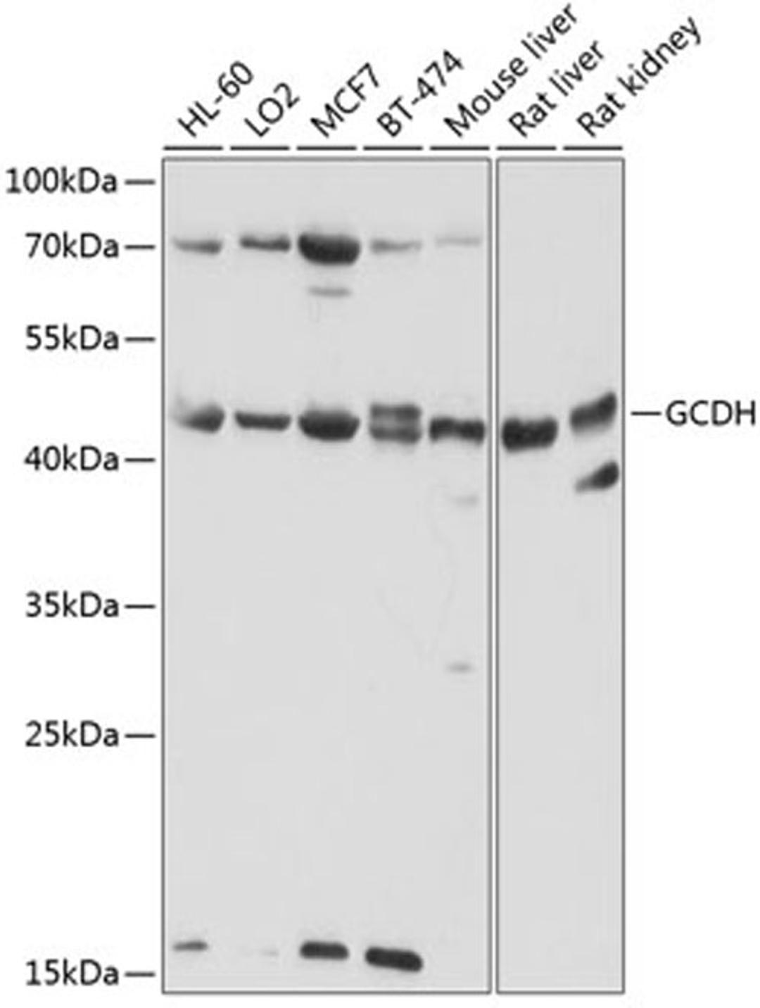 Western blot - GCDH antibody (A9057)