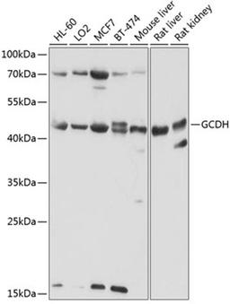 Western blot - GCDH antibody (A9057)