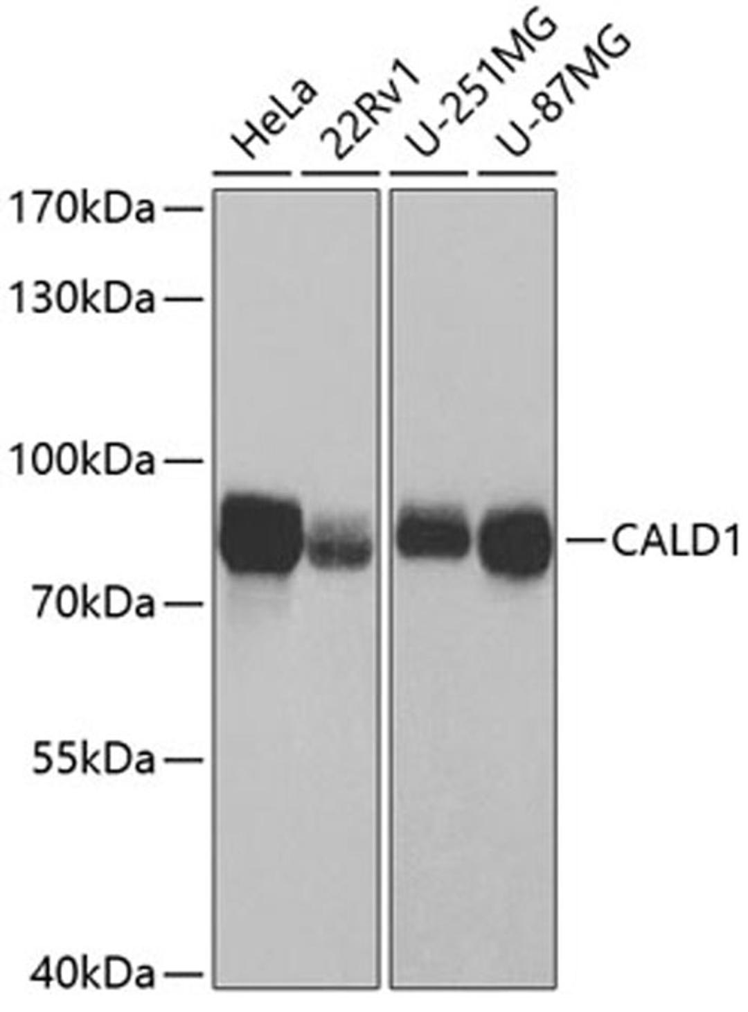 Western blot - CALD1 antibody (A5366)