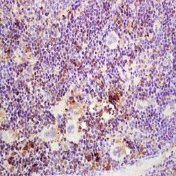 Immunohistochemical analysis of formalin-fixed and paraffin embedded mouse intestine tissue (dilution at:1:200) using 52kDa Ro/SSA antibody