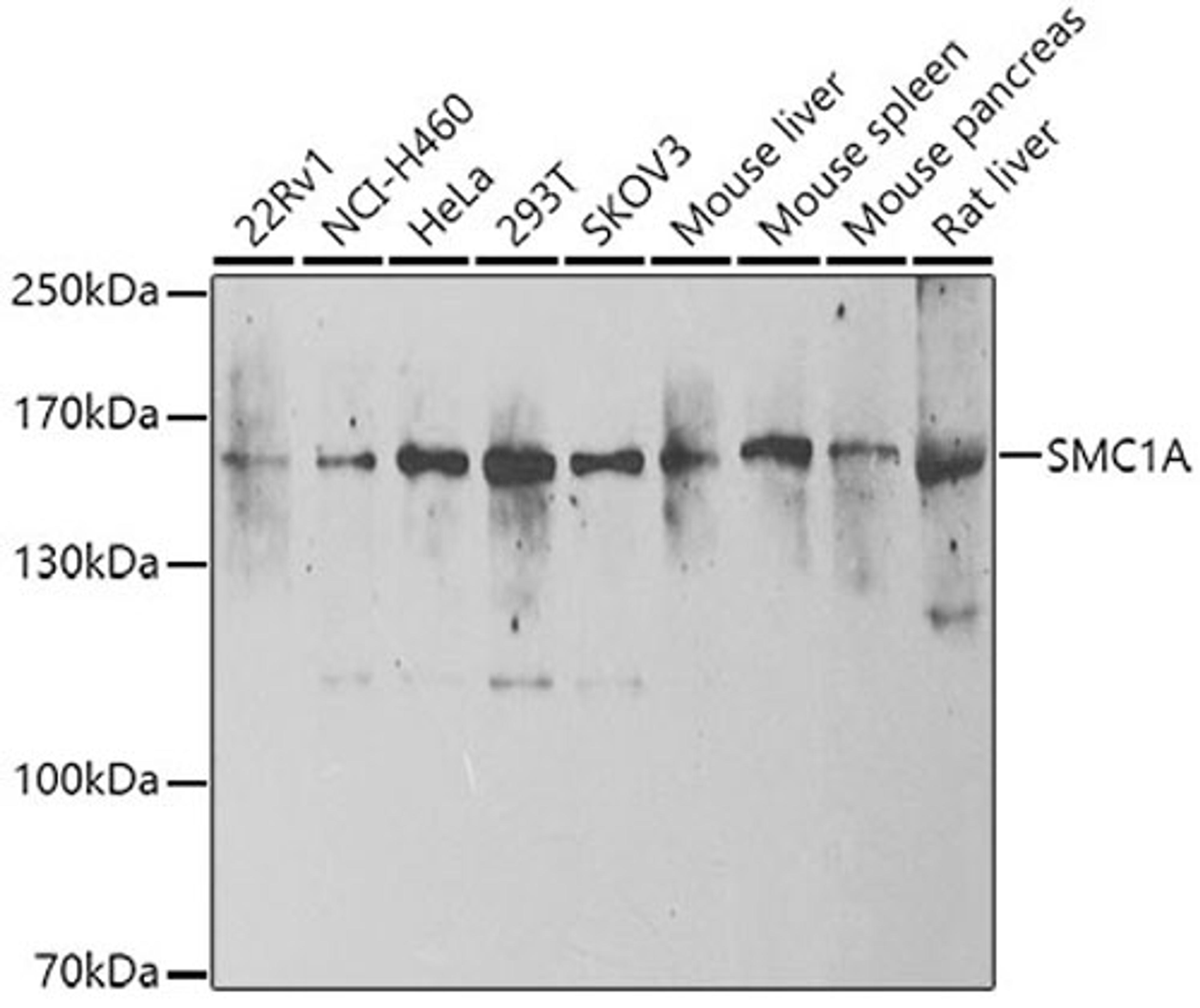 Western blot - SMC1A antibody (A7008)