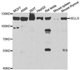 Western blot analysis of extracts of various cell lines using HELLS antibody