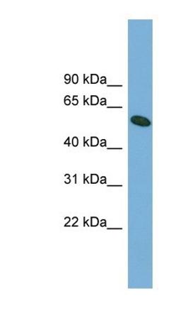 Western Blot: OMA1 Antibody [NBP1-56970] - Nuclear Lysate, Whole cell lysate, Antibody Titration: 0.2-1 ug/ml.