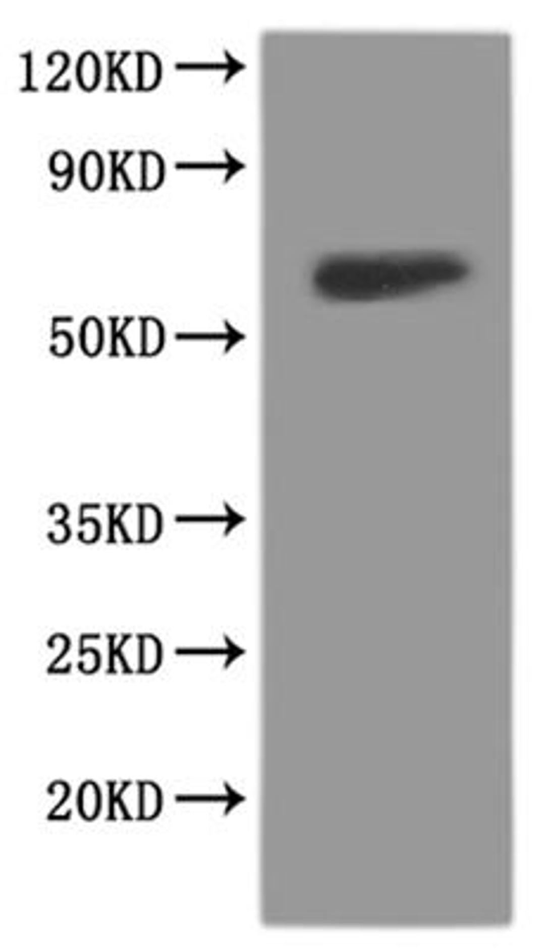 CSB-MP009911RA2f4 is detected by Mouse anti-GFP monoclonal antibody.