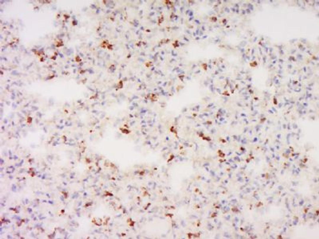 Immunohistochemical staining of Rat lung tissue using GNG11 antibody.