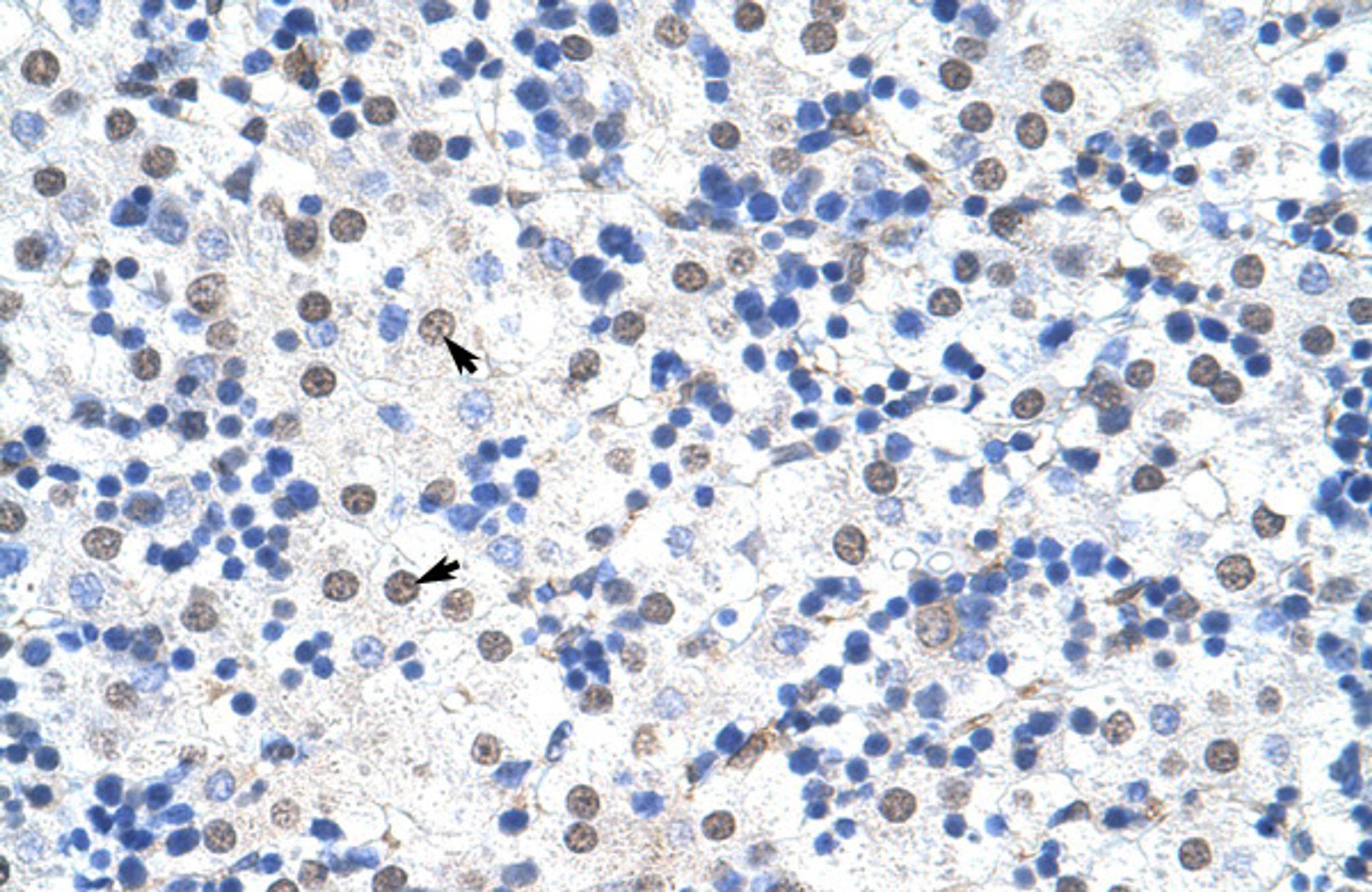 Antibody used in IHC on Human Liver.