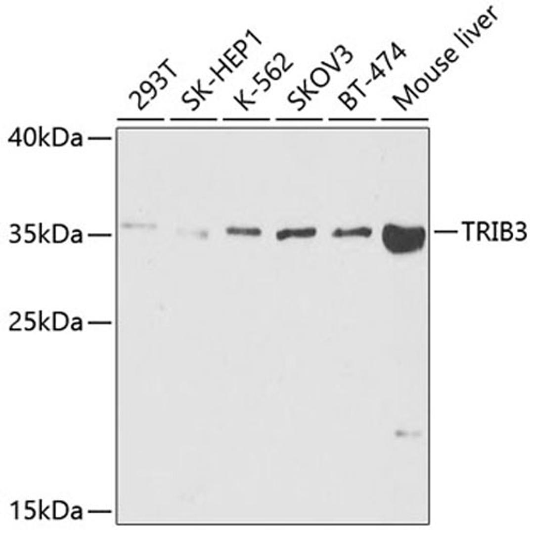 Western blot - TRIB3 antibody (A5424)