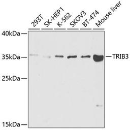 Western blot - TRIB3 antibody (A5424)