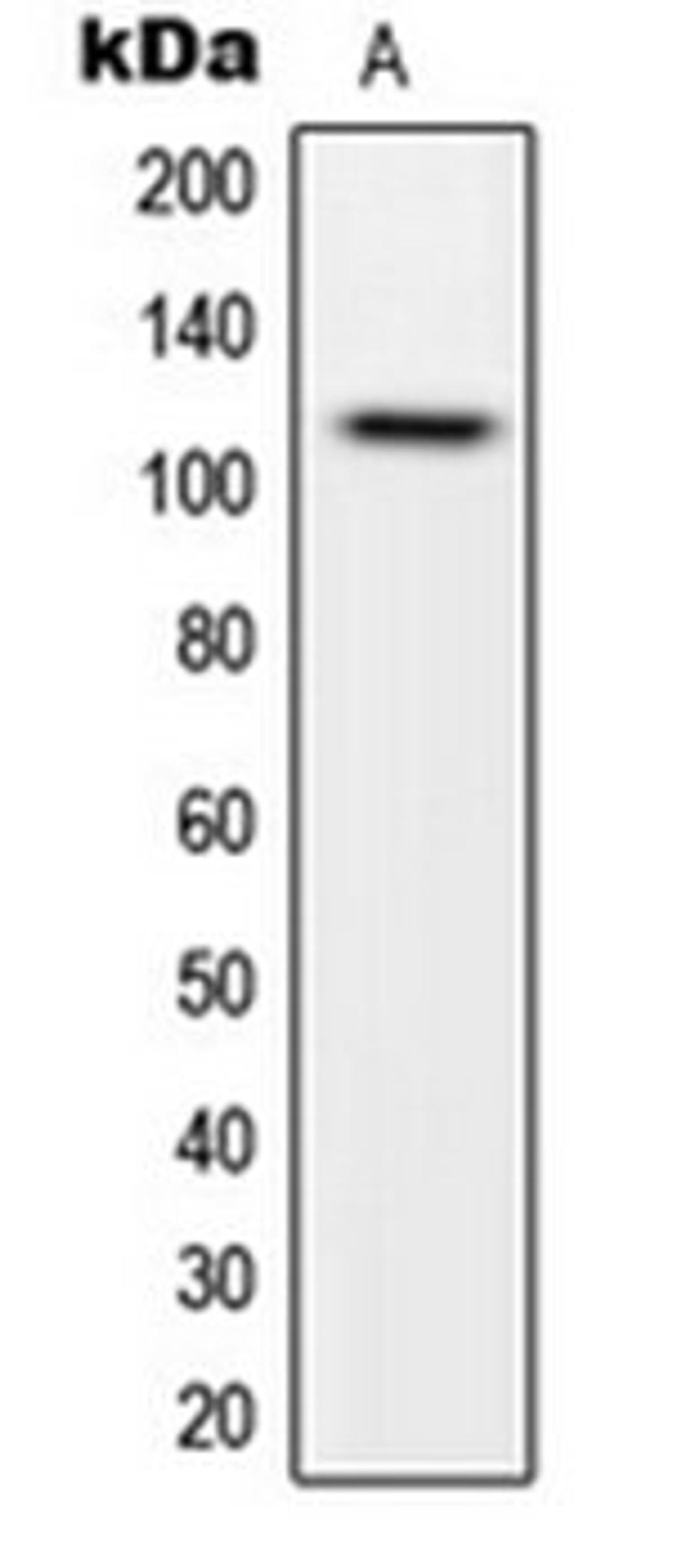 Western blot analysis of HeLa (Lane 1) whole cell lysates using CARD14 antibody